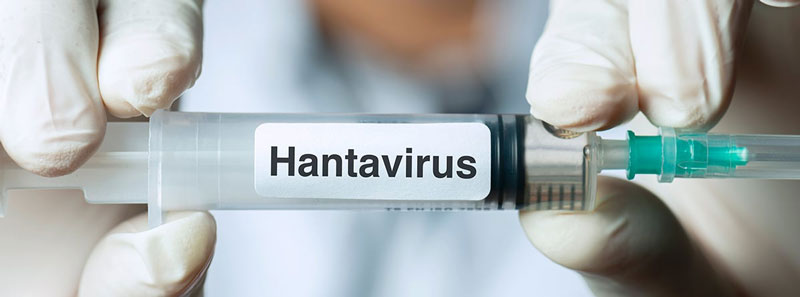 Aysén registró víctima fatal por hantavirus: fallece buzo de 31 años y surgen cuestionamientos